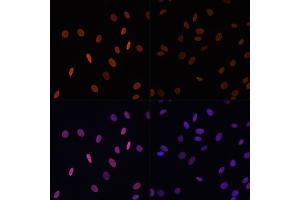 Immunofluorescence analysis of NIH/3T3 cells using Acetyl-Histone H2B-K12 antibody (ABIN7267731) at dilution of 1:100. (Histone H2B 抗体  (acLys12))