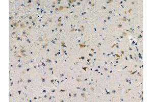 ABIN6257407 and ABIN6274203 at 1/100 staining Mouse brain tissue by IHC-P.