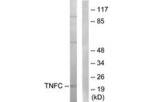 Western blot analysis of extracts from HepG2 cells, using TNFC Antibody. (LTB 抗体  (AA 181-230))