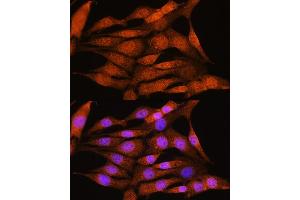 Immunofluorescence analysis of NIH/3T3 cells using BCL3 Rabbit pAb (ABIN6134239, ABIN6137509, ABIN6137510 and ABIN7101379) at dilution of 1:100. (BCL3 抗体  (AA 300-400))