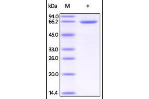 Human HSA, His Tag on SDS-PAGE under reducing (R) condition. (HSA Protein (AA 25-609) (His tag))