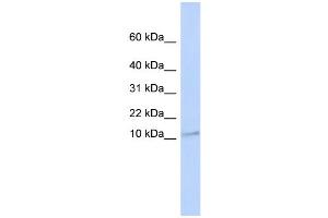 WB Suggested Anti-TMEM93 Antibody Titration:  0.