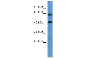 WB Suggested Anti-GPRC5B Antibody Titration: 0. (GPRC5B 抗体  (N-Term))