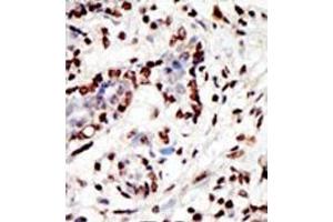 Image no. 1 for anti-Myeloid/lymphoid Or Mixed-Lineage Leukemia (MLL) (C-Term) antibody (ABIN356674) (MLL/KMT2A 抗体  (C-Term))