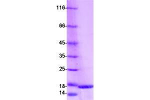 Western Blotting (WB) image for S100 Calcium Binding Protein A16 (S100A16) protein (Myc-DYKDDDDK Tag) (ABIN2731302)