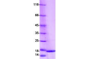 Validation with Western Blot (S100A16 Protein (Myc-DYKDDDDK Tag))