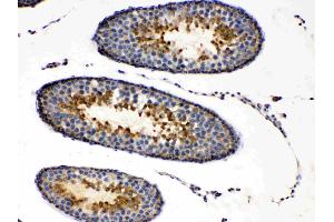Immunohistochemistry (IHC) image for anti-Protein Kinase, CAMP-Dependent, Regulatory, Type I, alpha (Tissue Specific Extinguisher 1) (PRKAR1A) (AA 2-81) antibody (ABIN5518788)