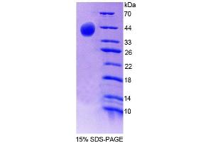 SDS-PAGE analysis of Mouse SYN2 Protein. (SYN2 蛋白)