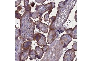 Immunohistochemical staining of human placenta with PLEKHG6 polyclonal antibody  shows strong membranous staining positivity in trophoblastic cells.
