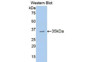 Western Blotting (WB) image for anti-Cadherin 1, Type 1, E-Cadherin (Epithelial) (CDH1) (AA 373-621) antibody (ABIN2901800)