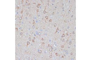 Immunohistochemistry of paraffin-embedded rat brain using COPG2 antibody (ABIN7266425) at dilution of 1:100 (40x lens). (COPG2 抗体  (AA 542-871))