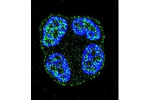 Confocal immunofluorescent analysis of SCUBE2 Antibody (Center ) (ABIN655409 and ABIN2844955) with ZR-75-1 cell followed by Alexa Fluor 488-conjugated goat anti-rabbit lgG (green). (SCUBE2 抗体  (AA 251-280))