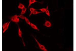 ABIN6274845 staining Hela by IF/ICC. (TMEM237 抗体  (Internal Region))