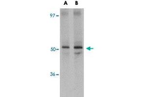 Western blot analysis of JMJD6 in human brain tissue lysate with JMJD6 polyclonal antibody  at (A) 1 and (B) 2 ug/mL . (JMJD6 抗体  (N-Term))