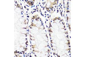 Immunohistochemistry (IHC) image for anti-Cullin-Associated and Neddylation-Dissociated 1 (CAND1) (AA 750-980) antibody (ABIN7266546)