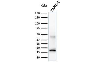Elastase 3B Antikörper  (AA 82-238)