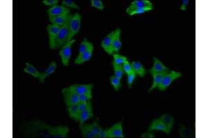 Immunofluorescence staining of HepG2 cells with ABIN7169835 at 1:66, counter-stained with DAPI. (KCNN3 抗体  (AA 240-426))