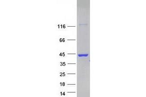 Western Blotting (WB) image for Lectin, Galactoside-Binding, Soluble, 8 (LGALS8) (Transcript Variant 1) protein (Myc-DYKDDDDK Tag) (ABIN2721646)