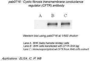 Image no. 2 for anti-Cystic Fibrosis Transmembrane Conductance Regulator (ATP-Binding Cassette Sub-Family C, Member 7) (CFTR) (N-Term) antibody (ABIN559718) (CFTR 抗体  (N-Term))