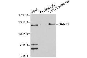 Immunoprecipitation analysis of 150ug extracts of Jurkat cells using 3ug SART1 antibody.