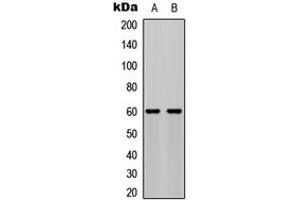 Western blot analysis of AKT (pS473) expression in MCF7 PDGF-treated (A), NIH3T3 PDGF-treated (B) whole cell lysates. (AKT1 抗体  (C-Term, pSer473))