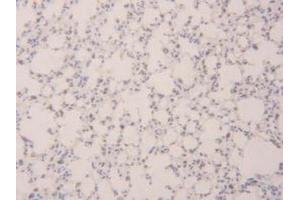 IHC-P analysis of Mouse Lung Tissue, with DAB staining. (SFTPB 抗体  (AA 20-193))