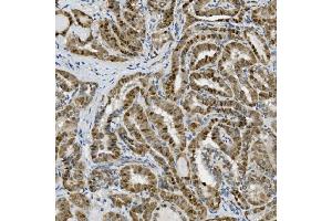 IHC analysis of Transketolase/TKT using anti-Transketolase/TKT antibody (ABIN7598957).