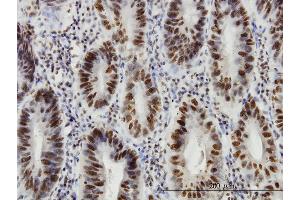 Immunoperoxidase of monoclonal antibody to HDAC1 on formalin-fixed paraffin-embedded human stomach. (HDAC1 抗体  (AA 1-482))