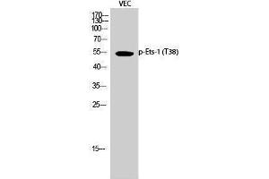 Western Blotting (WB) image for anti-V-Ets erythroblastosis Virus E26 Oncogene Homolog 1 (Avian) (ETS1) (pThr38) antibody (ABIN3179743) (ETS1 抗体  (pThr38))
