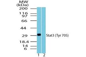 Image no. 1 for anti-Signal Transducer and Activator of Transcription 3 (Acute-Phase Response Factor) (STAT3) (pTyr705) antibody (ABIN960359)