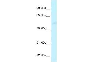 WB Suggested Anti-CPVL Antibody Titration: 1. (CPVL 抗体  (Middle Region))