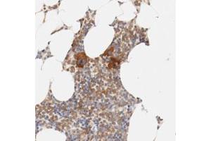 Immunohistochemical staining (Formalin-fixed paraffin-embedded sections) of human bone marrow with ZNF267 polyclonal antibody  shows strong cytoplasmic positivity in a subset of bone marrow poietic cells (megakaryocytes). (ZNF267 抗体)