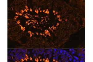 Immunofluorescence analysis of Rat testis using AKAP4 Polyclonal Antibody at dilution of 1:100. (AKAP4 抗体)