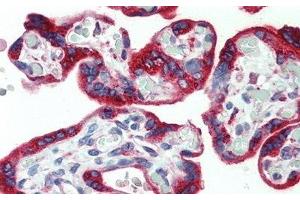 Detection of PDGFAA in Human Placenta Tissue using Monoclonal Antibody to Platelet Derived Growth Factor AA (PDGFAA) (PDGF-AA Homodimer (AA 87-211) 抗体)