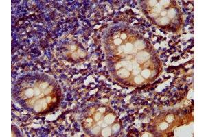 IHC image of ABIN7157812 diluted at 1:200 and staining in paraffin-embedded human appendix tissue performed on a Leica BondTM system. (LARP6 抗体  (AA 294-453))