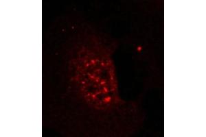 Immunofluorescence staining of methanol-fixed Hela cells showing nuclear dot staining using Akt(Phospho-Thr308) Antibody. (AKT1 抗体  (pThr308))