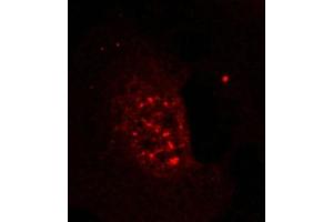 Immunofluorescence staining of methanol-fixed Hela cells showing nuclear dot staining using Akt(Phospho-Thr308) Antibody.