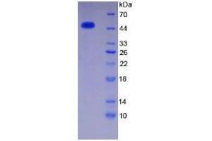 SDS-PAGE analysis of Human Thrombin Protein. (SERPINC1 蛋白)