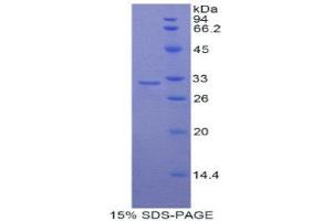 SDS-PAGE (SDS) image for Myosin IC (MYO1C) (AA 728-987) protein (His tag) (ABIN1877765) (Myosin IC Protein (MYO1C) (AA 728-987) (His tag))
