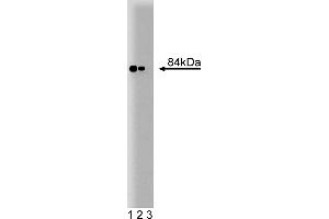 Western Blotting (WB) image for anti-Stromal Interaction Molecule 1 (STIM1) (AA 25-139) antibody (ABIN968271) (STIM1 抗体  (AA 25-139))