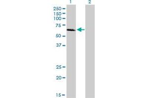 Western Blot analysis of IRAK1 expression in transfected 293T cell line by IRAK1 monoclonal antibody (M02), clone 3A9.