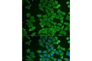 Immunofluorescence analysis of U2OS cells using DDAH2 Polyclonal Antibody (DDAH2 抗体)