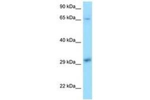 Image no. 1 for anti-Xeroderma Pigmentosum, Complementation Group A (XPA) (C-Term) antibody (ABIN6748095) (XPA 抗体  (C-Term))