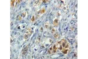IHC-P analysis of Ovary tissue, with DAB staining. (TNFRSF10B 抗体  (AA 234-435))