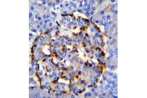 Immunohistochemistry analysis in formalin fixed and paraffin embedded human pancrease tissue reacted with PLA2G2D Antibody (C-term) followed which peroxidase conjugated to the secondary antibody and was followed by DAB staining.