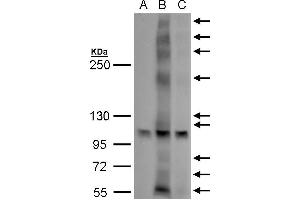 WB Image GPR30 antibody detects GPR30 protein by western blot analysis. (GPER 抗体  (C-Term))