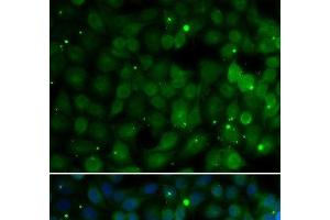 Immunofluorescence analysis of U2OS cells using HPD Polyclonal Antibody (HPD 抗体)