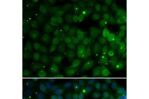 Immunofluorescence analysis of U2OS cells using HPD Polyclonal Antibody (HPD 抗体)
