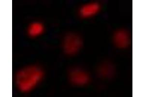 ABIN6274308 staining Hela cells by IF/ICC. (Foxk1 抗体  (Internal Region))