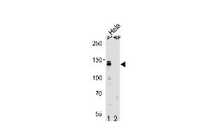 Western blot analysis of CUL4B Antibody (Center) Pab (ABIN1881241 and ABIN2839068) pre-incubated without(lane 1) and with(lane 2) blocking peptide in Hela cell line lysate. (Cullin 4B 抗体  (AA 250-278))